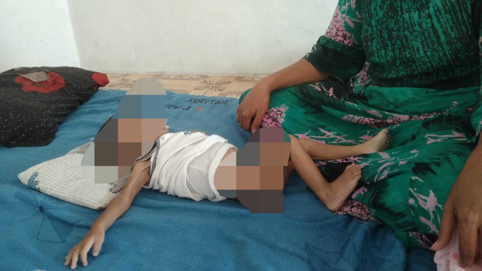 Potret seorang bayi diagnosa penderita gizi buruk asal Kelurahan Sipolu-polu, Kabupaten Mandailing Natal (ist)